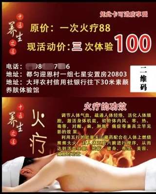 火疗名片图片