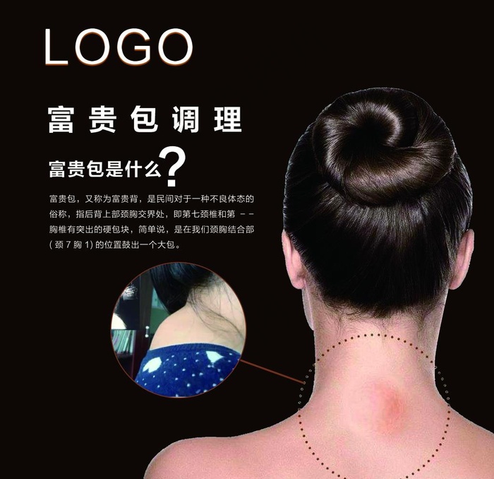 肩颈富贵包调理图片(1616X1616(DPI:72))psd模版下载