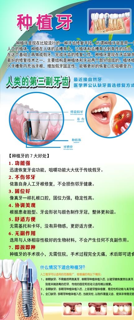 种植牙广告图片(2268X5017(DPI:72))psd模版下载