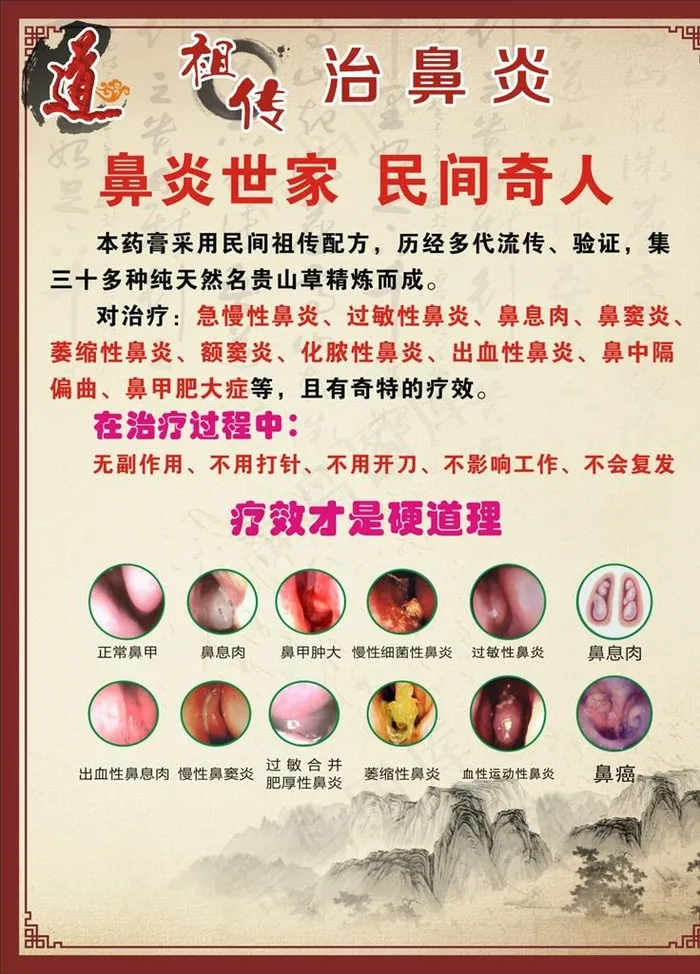鼻炎 鼻炎病症图 中医 养生图片