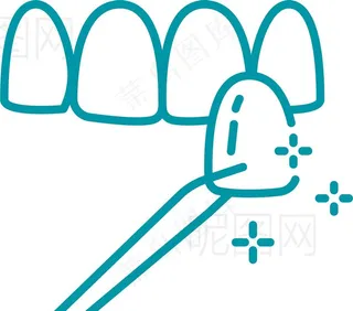牙贴面图片