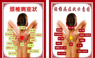 颈椎病 症状示意图 颈椎病症状图片