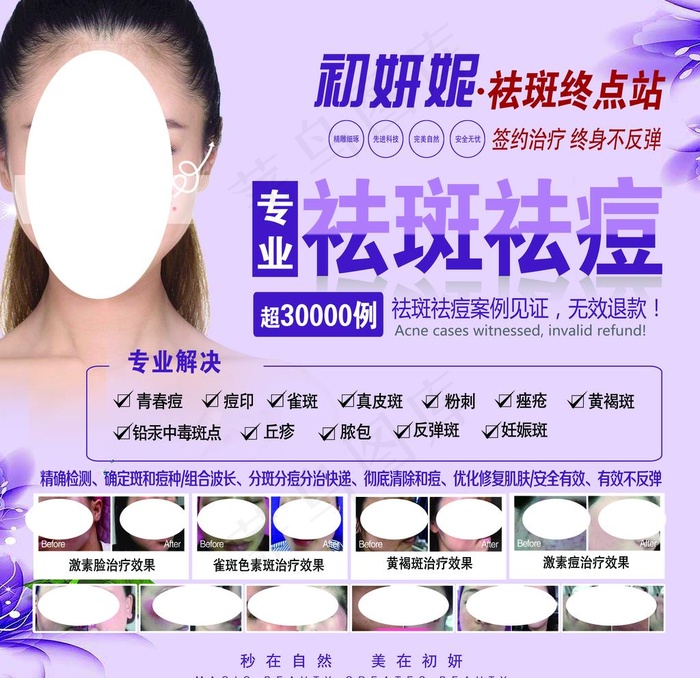专业祛斑祛痘图片(6732X6732(DPI:150))psd模版下载