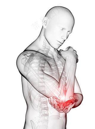 人体医疗透视图图片