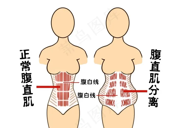 产后修复漫画图片(9449X7087(DPI:300))psd模版下载