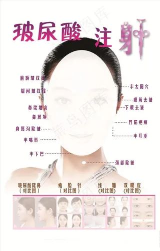 玻尿酸 注射图片