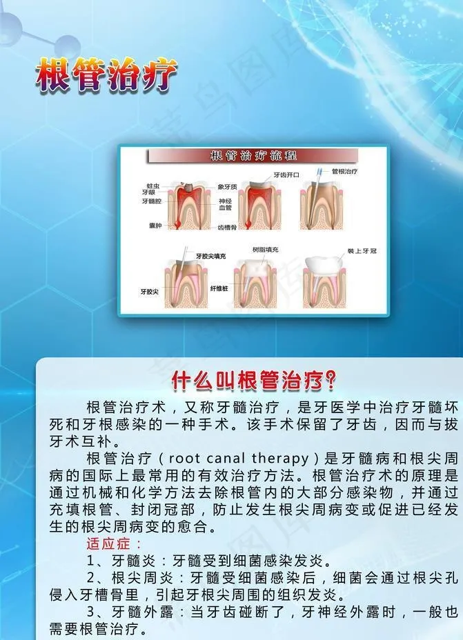 根管治疗海报图片(3000X4181(DPI:150))psd模版下载