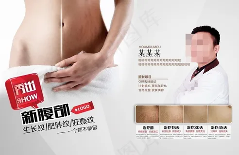 修复妊娠纹图片