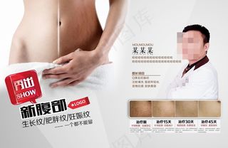 修复妊娠纹图片