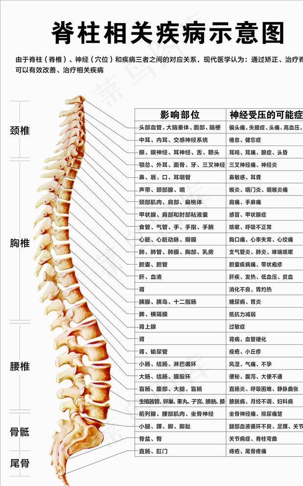 脊柱相关疾病示意图图片cdr矢量模版下载