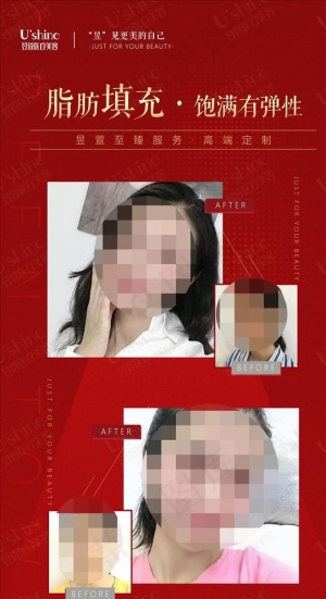 医美整形医院案例对比海报图片