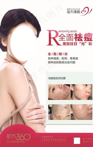 苗方清颜 祛痘图片