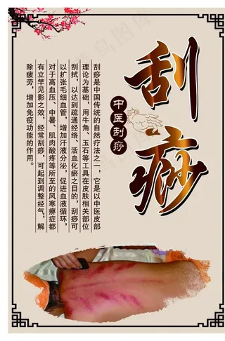 刮痧图片