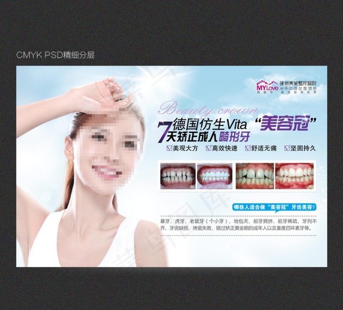 7天矫正成人畸形牙图片