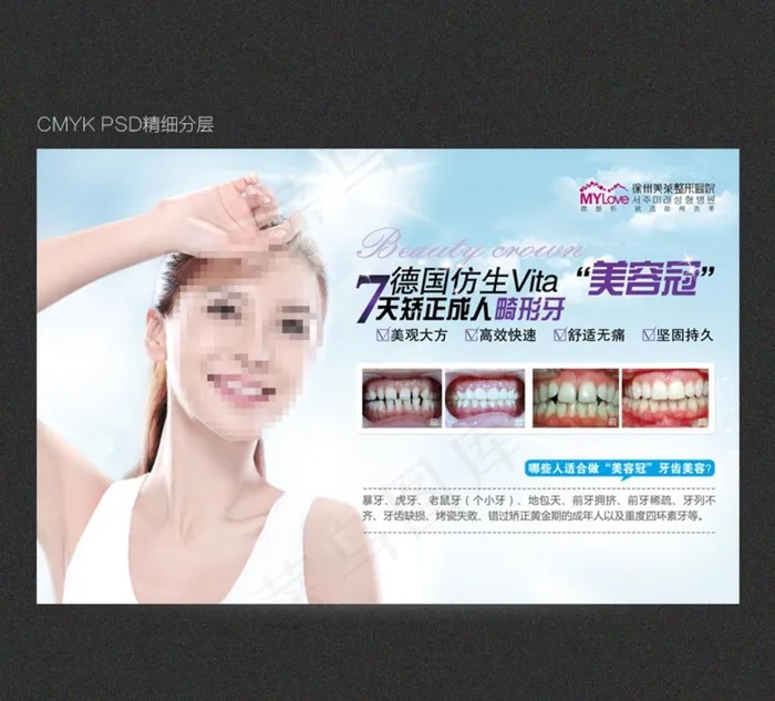 7天矫正成人畸形牙图片(6693X4331(DPI:200))psd模版下载