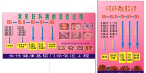 妇科病病变过程`图片