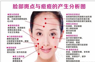 痘痘斑点脸部产生分析图图片