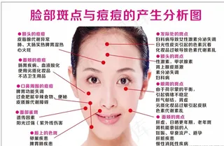 痘痘斑点脸部产生分析图图片