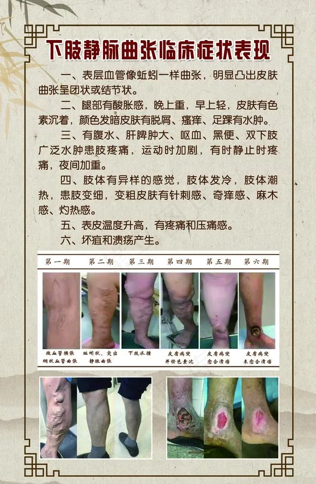 中医展板图片(2362X3740(DPI:50))psd模版下载