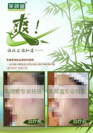 芙颜堂美容祛痘案例对比图图片