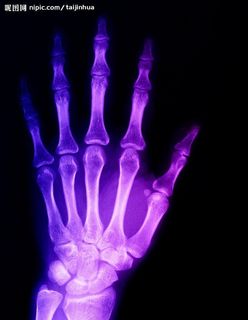 X光 手骨 医疗 科技卫生图片