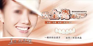 全瓷贴面图片
