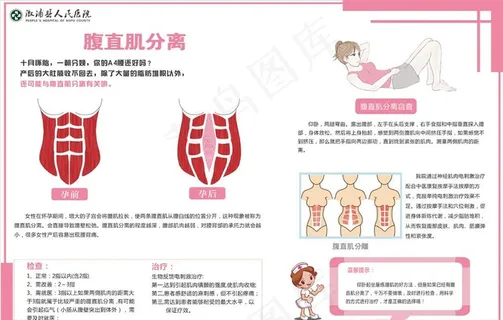 腹直肌分离图片