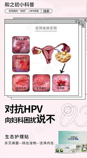 女性 生殖保养图片
