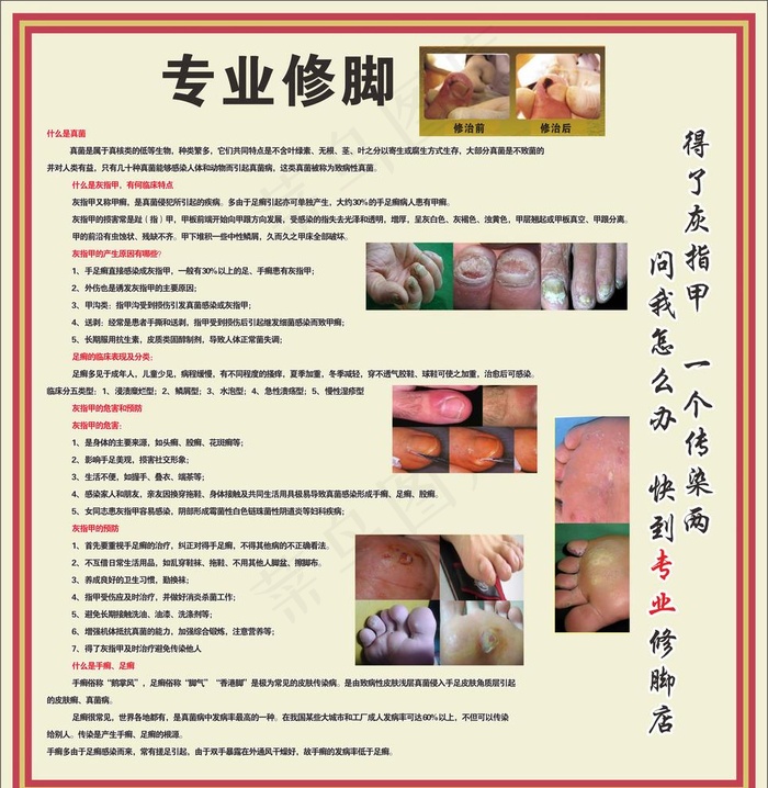 专业修脚图片cdr矢量模版下载