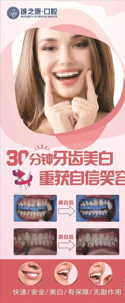 牙齿美白展架图片