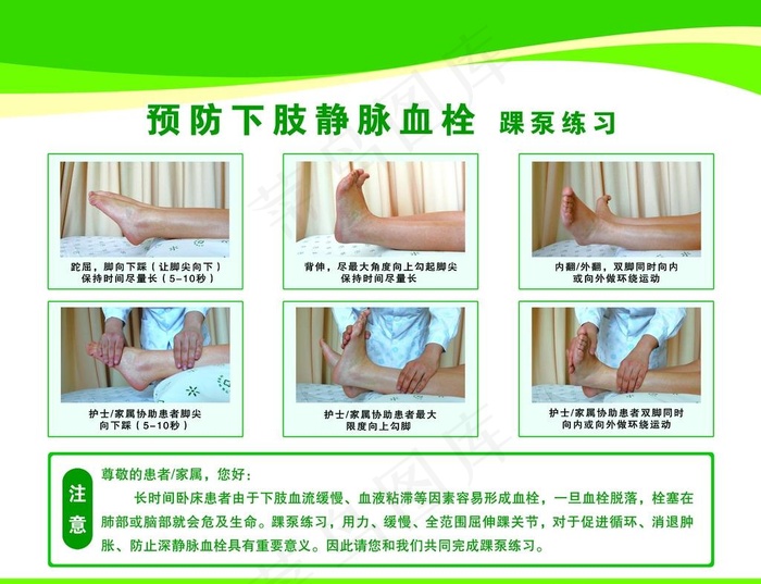 静脉血栓图片