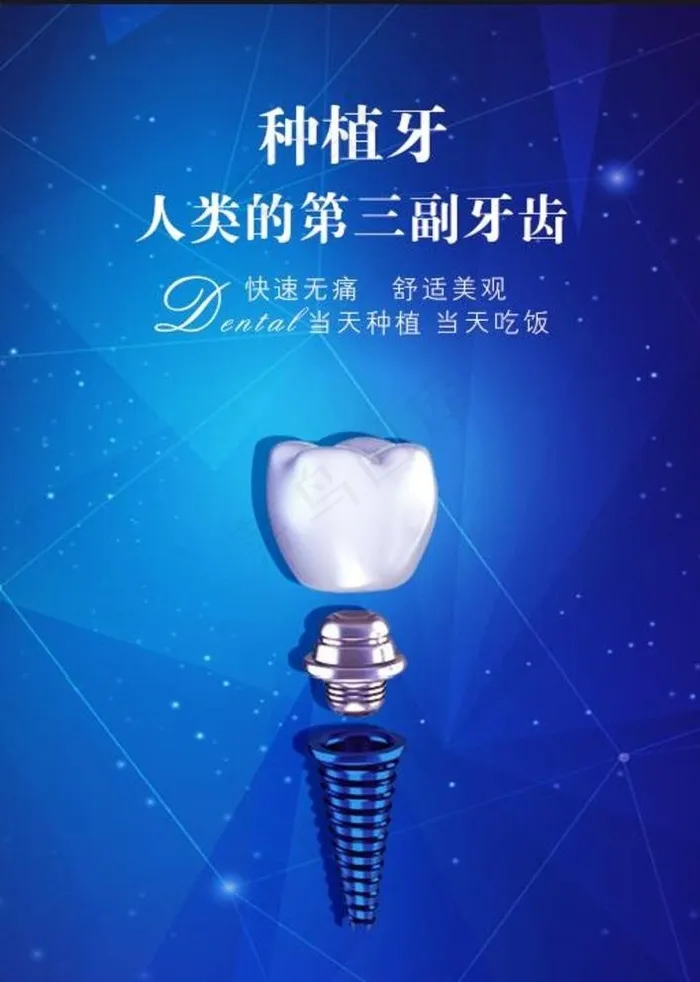 种植牙海报图片(4134X5906(DPI:150))psd模版下载