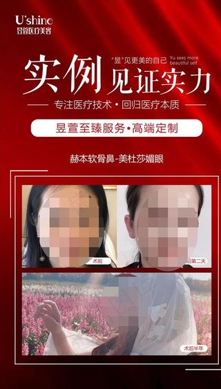 医美整形医院案例对比海报图片