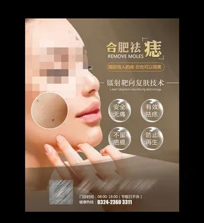 祛痣图片