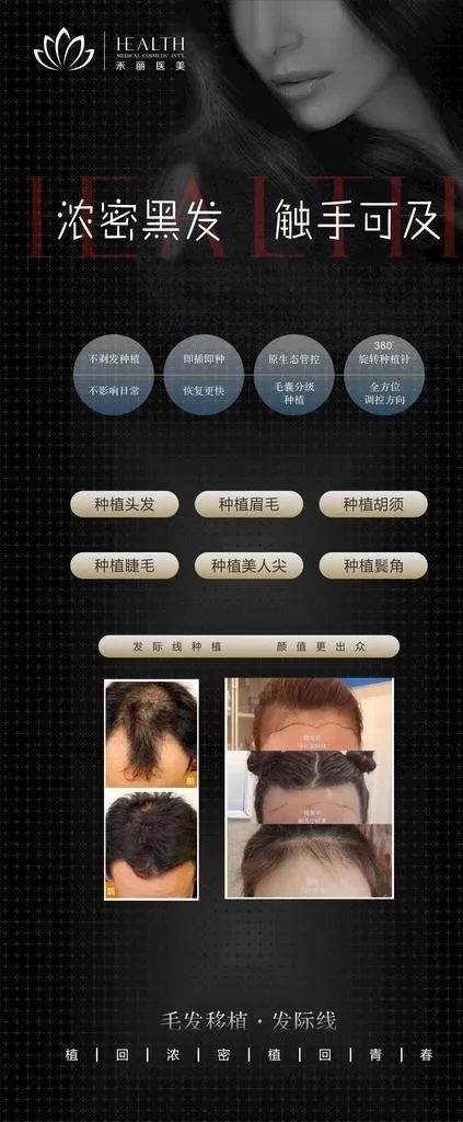 展架植发图片cdr矢量模版下载