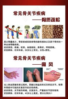 骨质疏松海报图片