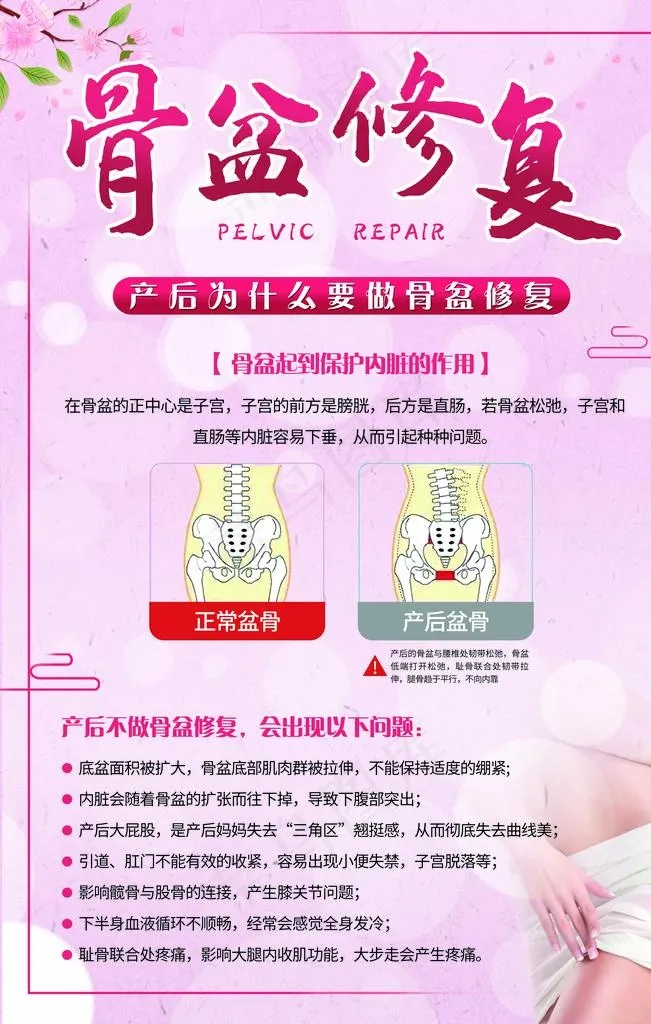 产后骨盆修复图片(3543X5315(DPI:150))psd模版下载