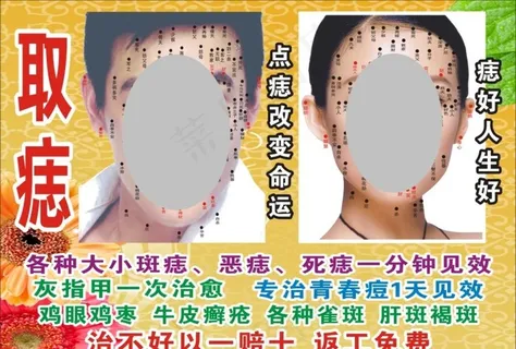 点痣图 面痣图 化妆点图片