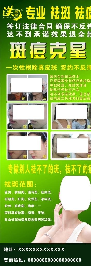 渼颜堂祛斑展架图片