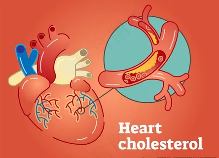 医学心脏血管插画设计图片 医学心脏血管插画设计图片
