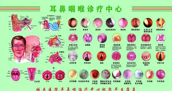 耳鼻喉挂图图片