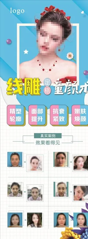 线雕童颜术图片