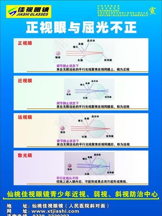 正视眼与屈光不正图片
