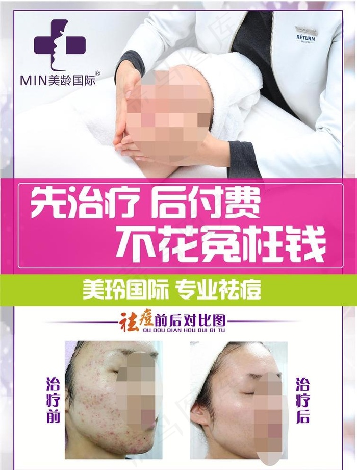 祛痘海报图片(2480X3366(DPI:300))psd模版下载