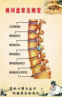 颈椎病症状  肩颈的保养  脐图片