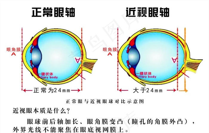 眼轴示意图图片cdr矢量模版下载