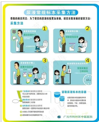 尿液常规标本采集方法图片
