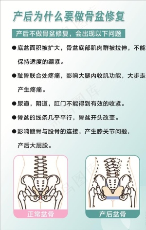产后修复 产后图片