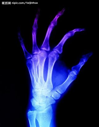 X光 手骨 医疗 科技卫生图片