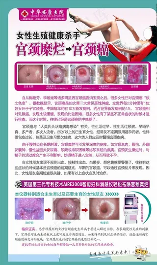 妇科疾病宫颈糜烂癌易拉宝展架图片